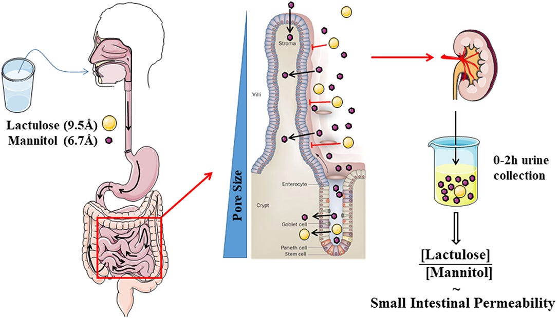 Leaky Gut caused by Endotoxin in Jabs