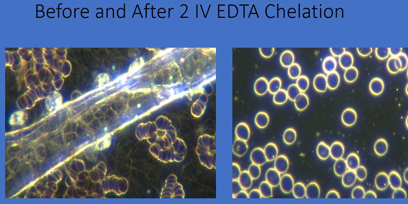 Decontaminating The Blood From Synthetic Biology Hydrogel With EDTA Chelation - Live Blood Documentation 