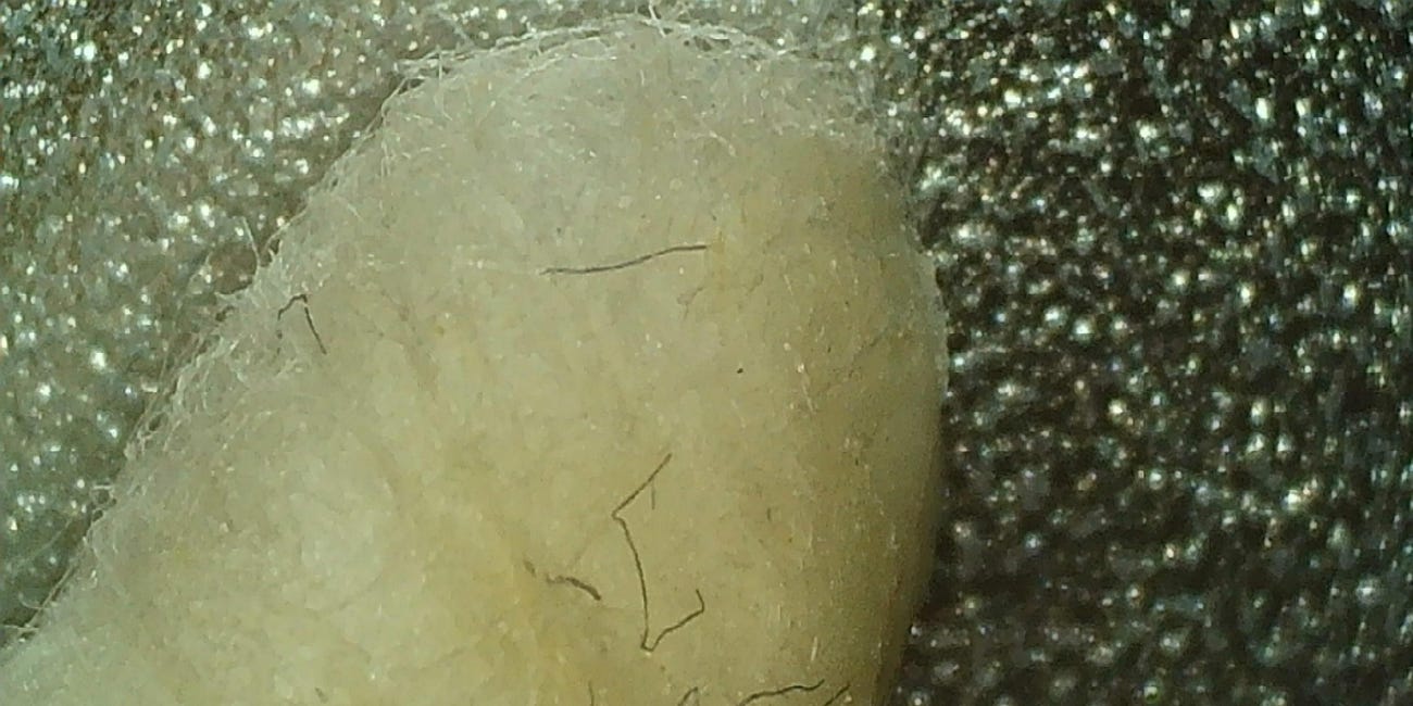 My body is producing NANOWIRES. I asked ChatGPT about it...