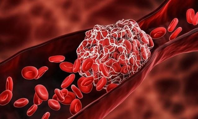 Japanese Researchers: Covid-19 Vaccines Damage the Blood and Spread Further Destruction Through Blood Transfusions