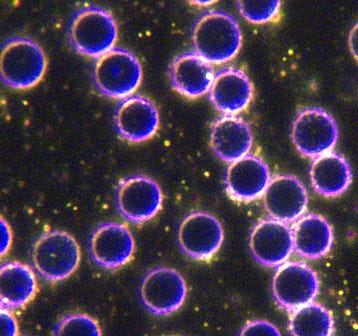 Altered blood cells, notes from study.