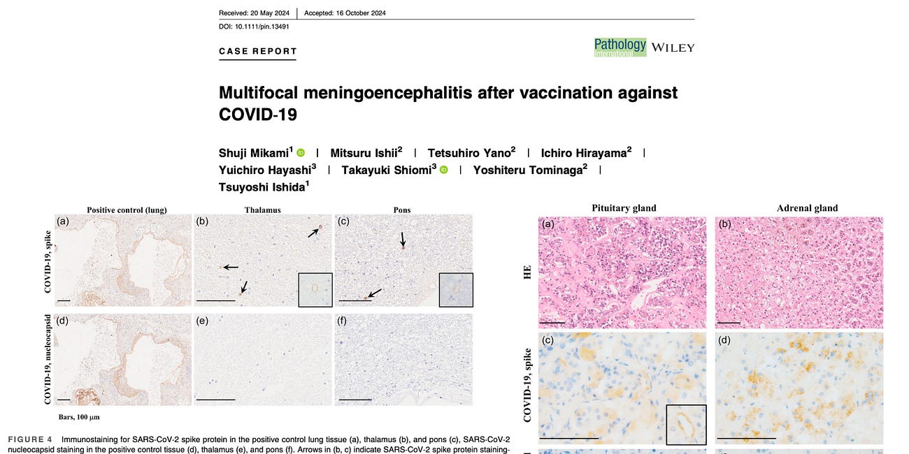 Autopsies Find Widespread Dissemination of Vaccine Spike Protein In Various Tissues and Organs