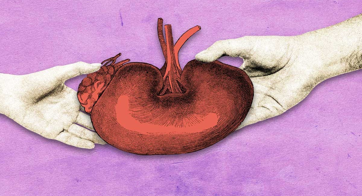 I Had Two Kidney Transplants. I Want Donors to Get Paid.