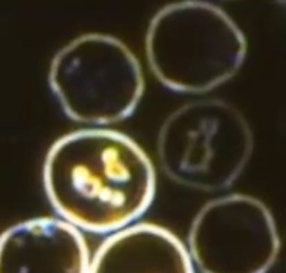Blood cells forming material inside.