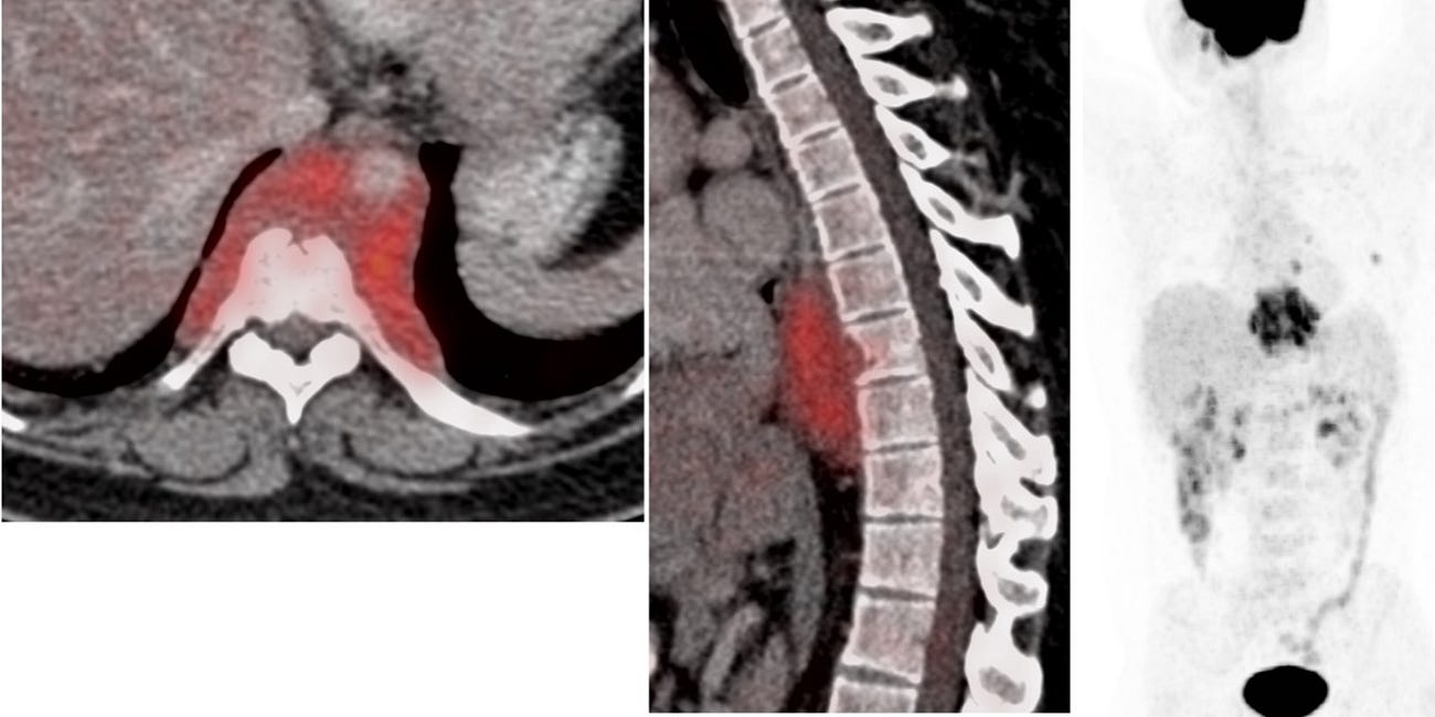 Case 52: The Dorsal Clue
