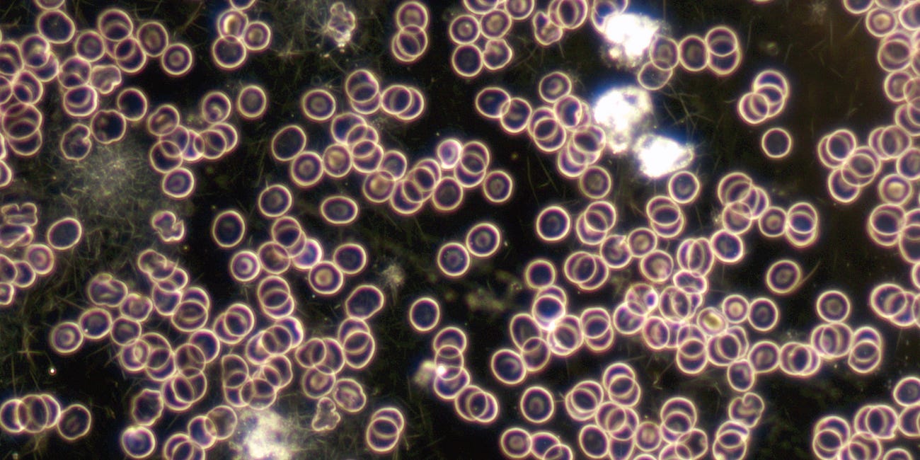 Darkfield Liveblood Analysis