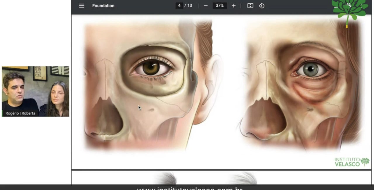 MD Codes FUNDATION: O inicio da Reestruturação Facial 