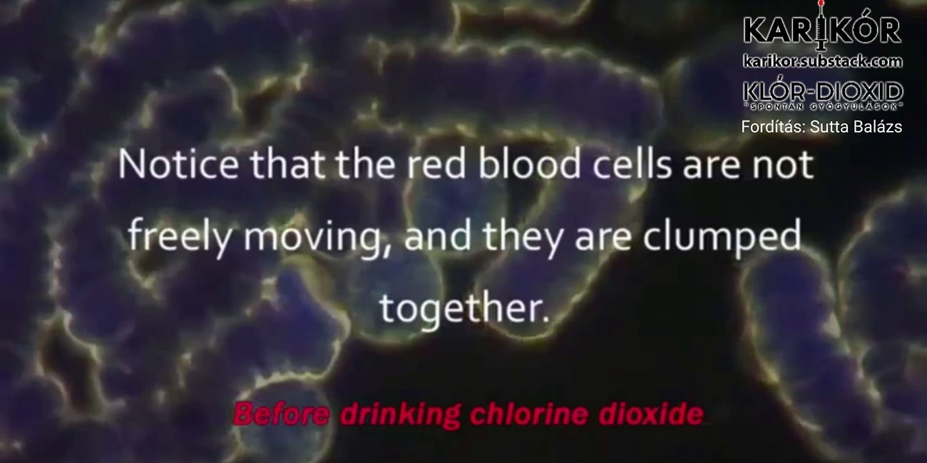 A klór-dioxid (CDS) vérre, illetve a hemoglobinra gyakorolt hatása, orális, illetve a vérrel történő közvetlen találkozásakor (MAGYAR HANGGAL)