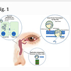 COVID Eye Infection