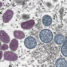 Monkeypox Virtue Signaling Is NOT A Solution