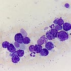 Can You Grade Canine Mast Cell Tumors on Cytology???