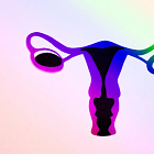 New York Times Notices That Overturning Roe Didn't Stop People From Needing Abortions