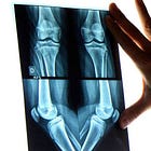 ¿Cómo me organizo para estudiar traumatología?