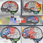 Predicting Clinical Dementia Ratings From fMRI Data