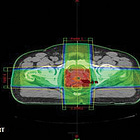 Non-inferiority Trial Design (REFERENCE SERIES)