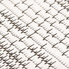 New-onset atrial fibrillation provoked by sepsis: anticoagulate or not?