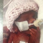 My Daughter Was Born at 24 Weeks