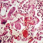 Never Mind Bird Flu, RFK Jr.'s CDC Is Going To Study If Vaccines Cause Autism, AGAIN