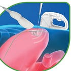 Intensivists can now place PEG tubes (PUGs, actually)