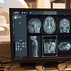Ezra, the Cancer Screening Startup, Is Bringing Bryan Johnson’s Longevity Secrets to the Public