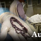 Autopsies