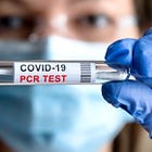 ΠΑΤΕΝΤΑ: PCR ΤΕΣΤ ΠΟΥ ΣΥΝΔΕΕΤΑΙ ΜΕ ΤΗΝ ΑΝΘΡΩΠΙΝΗ ΚΛΩΝΟΠΟΙΗΣΗ