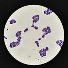Candida auris: What to know