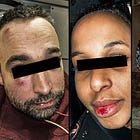 Expo-profiler brutalt misshandlade av invandrargäng – mitt på rödgröna Södermalm