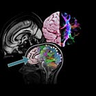 Prefrontale cortex – (PFC)