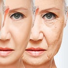 What exactly is aging?