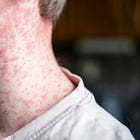 From Measles to MAHA: The Politics of Crunchy Moms
