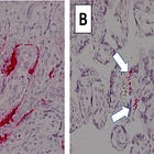 What COVID-19 Does To The Body (Fifth Edition, August 2024)