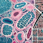 The best metaphor for spatial transcriptomics