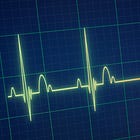 AHA Updates its Cardiac Arrest Guidelines
