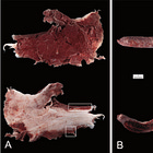 Conformal White Fibrin "Clots" are caused by Endotoxin in Jabs