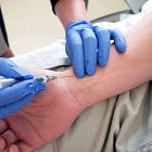 ¿Qué hacer ante un paciente con acidosis metabólica?