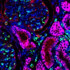 Signals Brief: Why Lux Capital is Betting Big on CRISPR and the Future of Organ Transplants