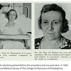 A Gluttony For Lobotomy
