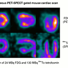 Nuclear medicine: 18F-FDG PET/CT for the detection of vaccine-induced pathologies