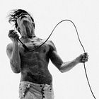 In defence of Yungblud – then and now