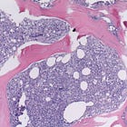 Demystifying Bone Marrow