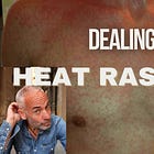 VIDEO - How I Found Relief from Debilitating Heat Rashes – Bee Pollen & My Cholinergic Urticaria Journey
