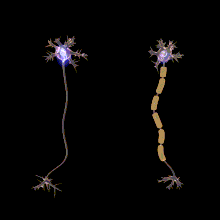 Représentation de 2 paires de neurones, une paire sans myéline, une autre paire avec myéline, on voit que le signale électrique va bien plus vite avec la myéline