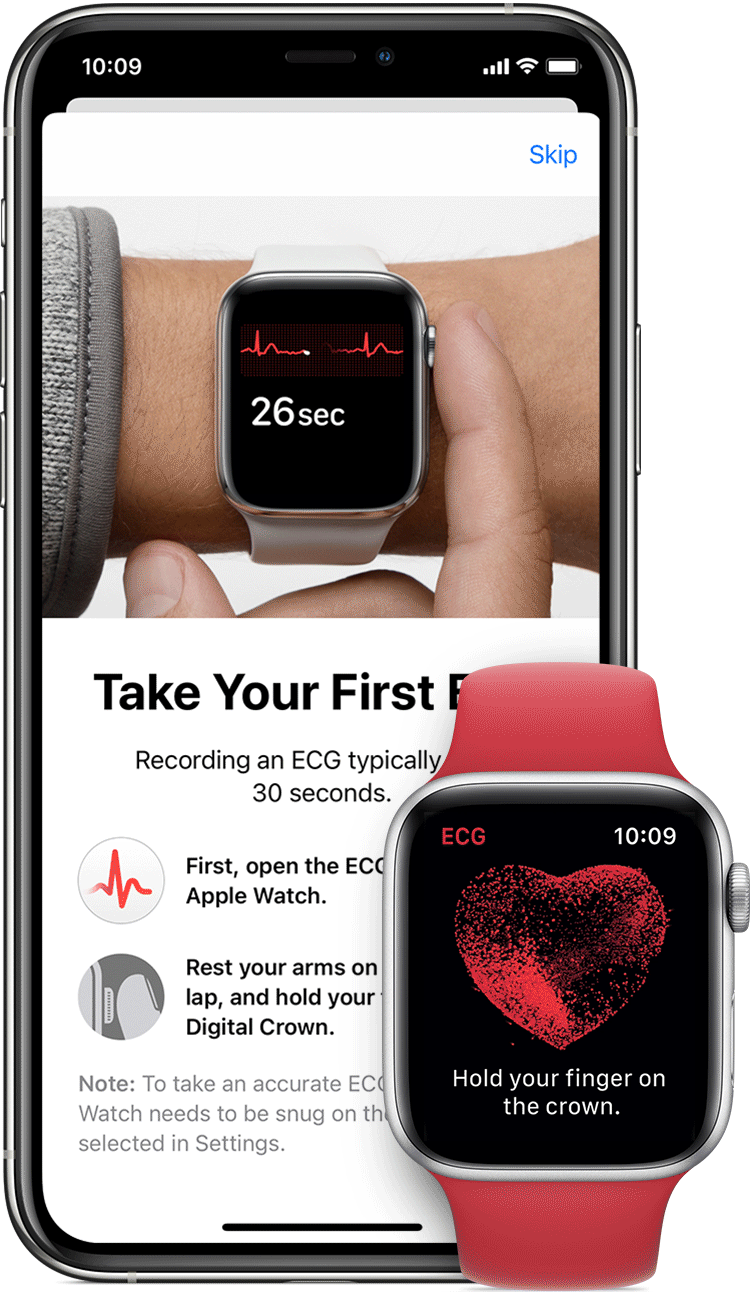 Taking an ECG with the ECG app on Apple Watch Series 4, Series 5, or Series  6 - Apple Support