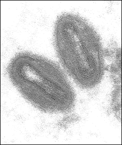 Electron micrograph of monkeypox virus