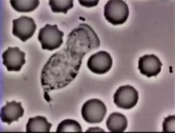 Neutrophil Phagocytosis - White Blood Cell Eats Staphylococcus Aureus  Bacteria G... | Gfycat