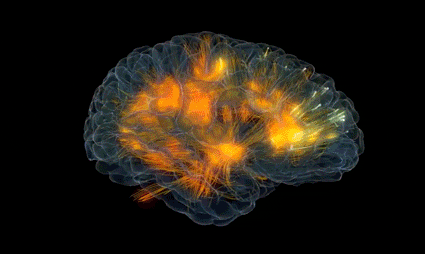 Neurofatigue / Invisible consequences / Consequences |  Braininjury-explanation.com