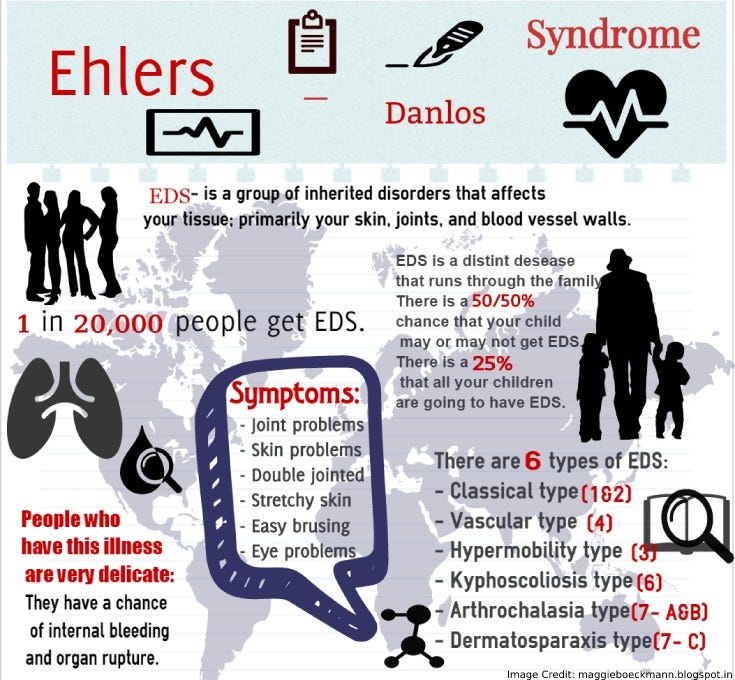 https://www.consumerhealthdigest.com/wp-content/uploads/2018/01/ehlers-danlos-.jpg