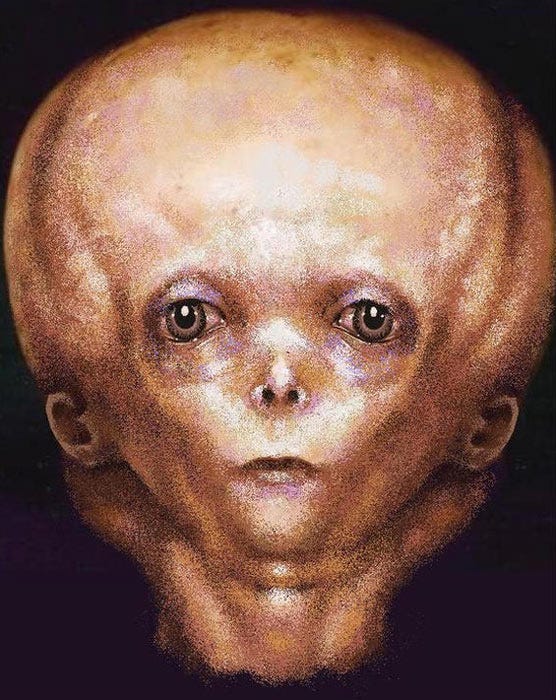 Artists depiction of how the child would have looked, after analysis of the Starchild Skull. (tonio48 / Deviant Art)