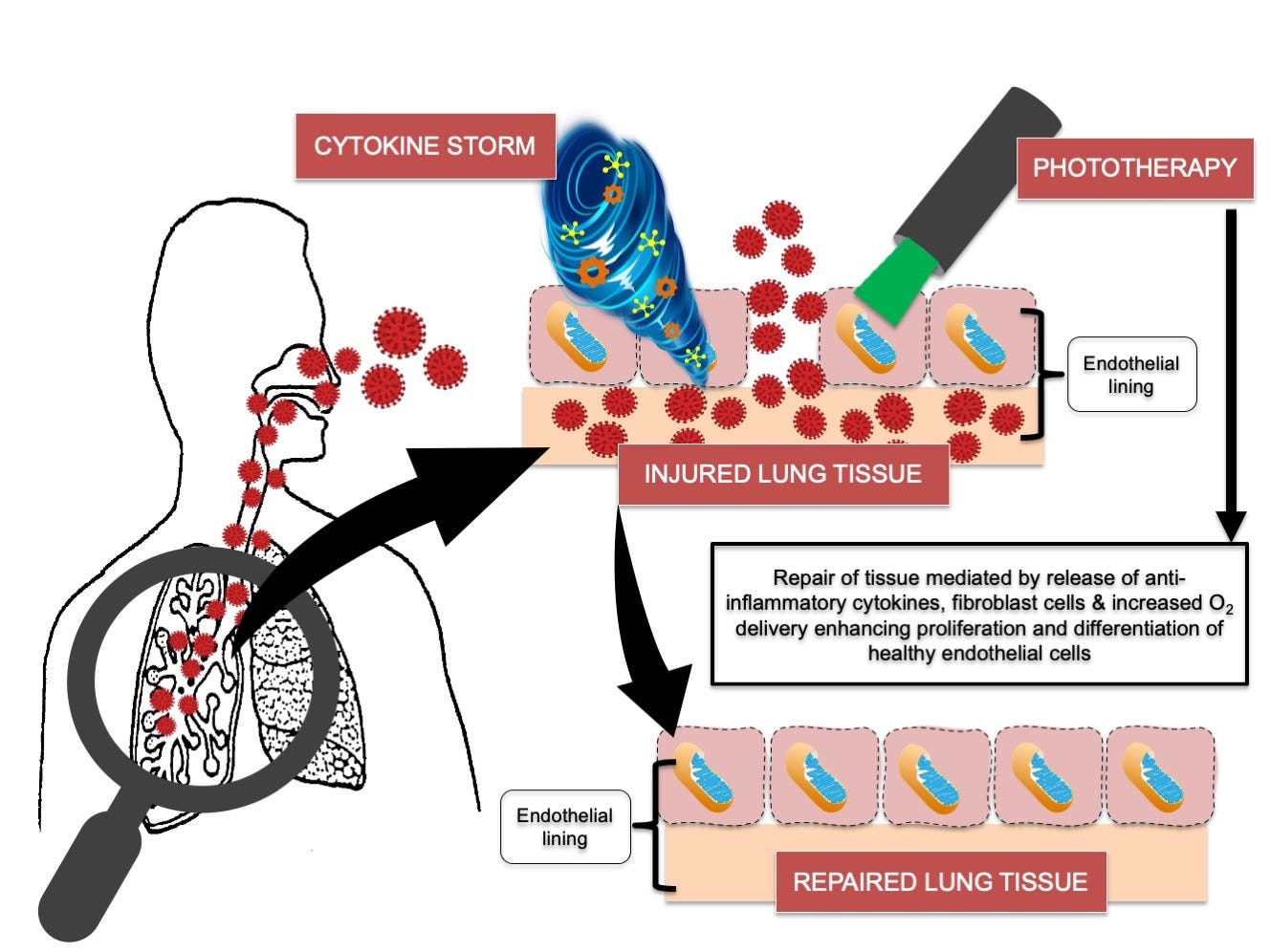 Antioxidants | Free Full-Text | Phototherapy as a Rational Antioxidant  Treatment Modality in COVID-19 Management; New Concept and Strategic  Approach: Critical Review